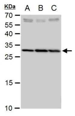 Invitrogen SLC25A6 Polyclonal Antibody 100 &mu;L; Unconjugated:Antibodies,