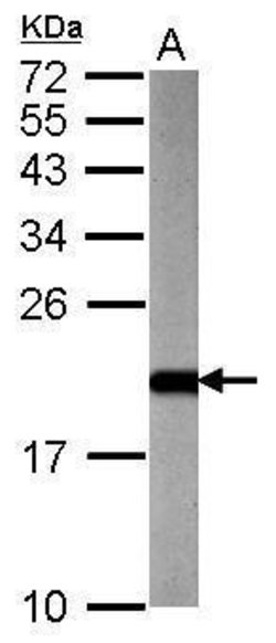 Invitrogen ARF3 Polyclonal Antibody 100 &mu;L; Unconjugated:Antibodies,