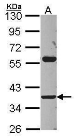 Invitrogen ART3 Polyclonal Antibody 100 &mu;L | Buy Online | Invitrogen&trade; | Fisher Scientific