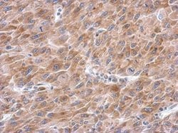 Invitrogen Asparagine Synthetase Polyclonal Antibody 100 &mu;L | Buy Online | Invitrogen&trade; | Fisher Scientific