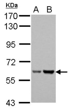 Invitrogen Asparagine Synthetase Polyclonal Antibody 100 &mu;L | Buy Online | Invitrogen&trade; | Fisher Scientific