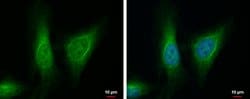 Invitrogen ALDH7A1 Polyclonal Antibody 100 μL; Unconjugated:Antibodies,