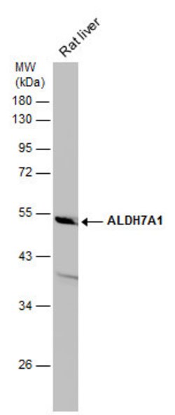 Invitrogen ALDH7A1 Polyclonal Antibody 100 μL; Unconjugated:Antibodies,
