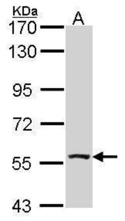 Invitrogen ALDH7A1 Polyclonal Antibody 100 μL; Unconjugated:Antibodies,