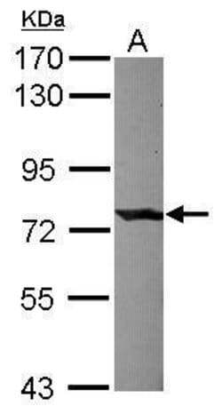 Invitrogen C1S Polyclonal Antibody 100 &mu;L; Unconjugated:Antibodies,