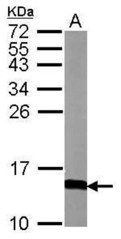 Invitrogen Calmodulin 3 Polyclonal Antibody 100 &mu;L | Buy Online | Invitrogen&trade; | Fisher Scientific