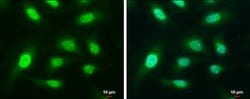 Invitrogen CAPG Polyclonal Antibody 100 &mu;L; Unconjugated:Antibodies,