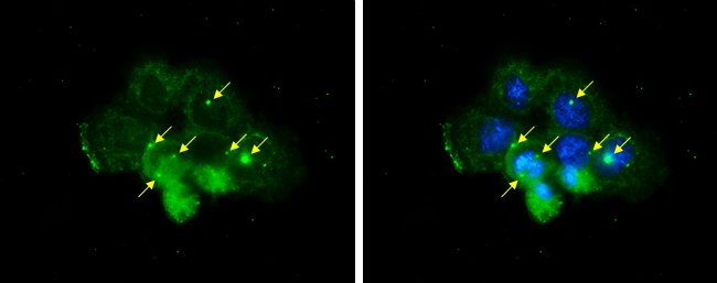 ゆ*民様 サーバント#　コングラ　PR-Di051P 2枚セット Centrin 1 Polyclonal Antibody, Invitrogen 100 μL