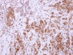 Invitrogen CHAD Polyclonal Antibody 100 &mu;L; Unconjugated:Antibodies,