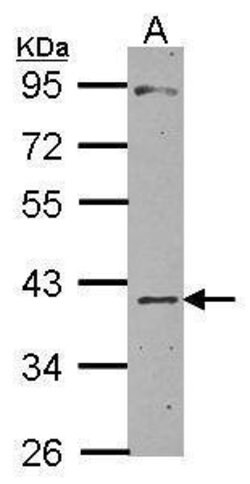 CHI3L2 Polyclonal Antibody, Invitrogen 100 &mu;L | Buy Online | Thermo Scientific | Fisher Scientific