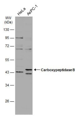 Invitrogen Carboxypeptidase B1 Polyclonal Antibody 100 &mu;L; Unconjugated:Antibodies,