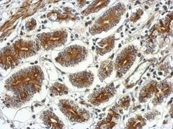 Invitrogen CSH2 Polyclonal Antibody 100 &mu;L; Unconjugated:Antibodies,