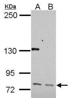 Invitrogen CUX1/Protein CASP Polyclonal Antibody 100 μL; Unconjugated:Antibodies,