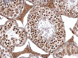 Invitrogen DRIL1 Polyclonal Antibody 100 &mu;L; Unconjugated:Antibodies,
