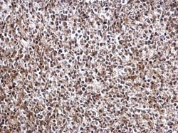 Invitrogen DRIL1 Polyclonal Antibody 100 &mu;L; Unconjugated:Antibodies,