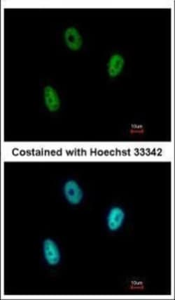 Invitrogen E2F6 Polyclonal Antibody 100 &mu;L | Buy Online | Invitrogen&trade; | Fisher Scientific