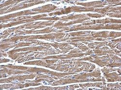 Invitrogen ECHS1 Polyclonal Antibody 100 &mu;L; Unconjugated:Antibodies,