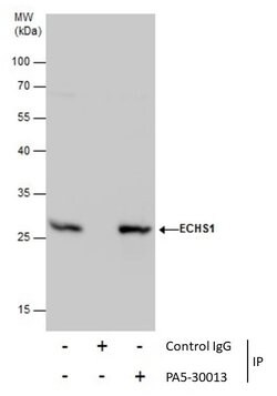 Invitrogen ECHS1 Polyclonal Antibody 100 &mu;L; Unconjugated:Antibodies,