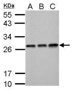 Invitrogen ECHS1 Polyclonal Antibody 100 &mu;L; Unconjugated:Antibodies,