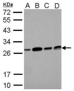 Invitrogen ECHS1 Polyclonal Antibody 100 &mu;L; Unconjugated:Antibodies,