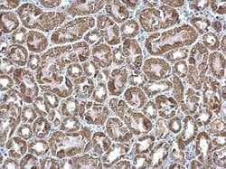 Invitrogen ETFA Polyclonal Antibody 100 &mu;L; Unconjugated:Antibodies,