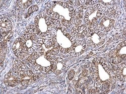 Invitrogen ETFA Polyclonal Antibody 100 &mu;L; Unconjugated:Antibodies,