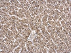 Invitrogen ETFA Polyclonal Antibody 100 &mu;L; Unconjugated:Antibodies,