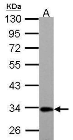 Invitrogen ETFA Polyclonal Antibody 100 &mu;L; Unconjugated:Antibodies,