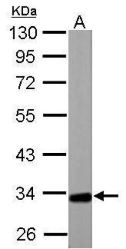 Invitrogen ETFA Polyclonal Antibody 100 &mu;L; Unconjugated:Antibodies,