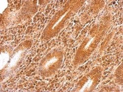 Invitrogen GARS Polyclonal Antibody 100 &mu;L; Unconjugated:Antibodies,