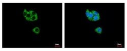 Invitrogen GCDH Polyclonal Antibody 100 &mu;L; Unconjugated:Antibodies,