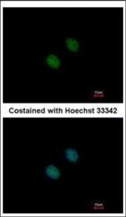 Invitrogen GCN5 Polyclonal Antibody 100 &mu;L; Unconjugated:Antibodies,