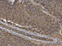 Invitrogen GNB1 Polyclonal Antibody 100 &mu;L | Buy Online | Invitrogen&trade; | Fisher Scientific