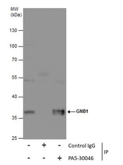 Invitrogen GNB1 Polyclonal Antibody 100 &mu;L | Buy Online | Invitrogen&trade; | Fisher Scientific