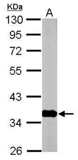 Invitrogen GNB1 Polyclonal Antibody 100 &mu;L | Buy Online | Invitrogen&trade; | Fisher Scientific