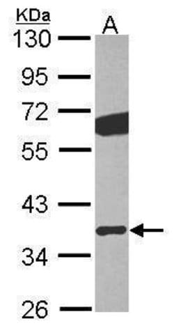 Invitrogen GNB2 Polyclonal Antibody 100 &mu;L; Unconjugated:Antibodies,