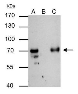 Invitrogen GTF2F1 Polyclonal Antibody 100 &mu;L | Buy Online | Invitrogen&trade; | Fisher Scientific