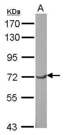 Invitrogen GTF2F1 Polyclonal Antibody 100 &mu;L | Buy Online | Invitrogen&trade; | Fisher Scientific
