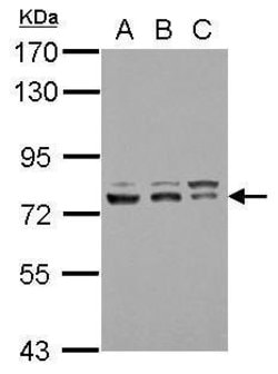 Invitrogen GTF2F1 Polyclonal Antibody 100 &mu;L | Buy Online | Invitrogen&trade; | Fisher Scientific