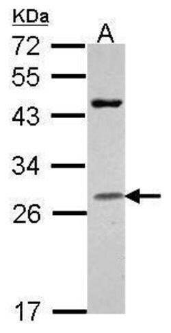 Invitrogen Granzyme H Polyclonal Antibody 100 &mu;L | Buy Online | Invitrogen&trade; | Fisher Scientific