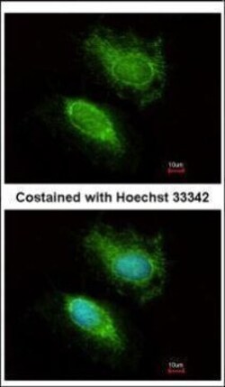 Invitrogen HIP2 Polyclonal Antibody 100 μL; Unconjugated:Antibodies,