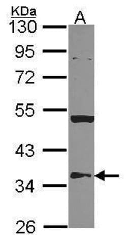 Invitrogen HMGCL Polyclonal Antibody 100 &mu;L; Unconjugated:Antibodies,