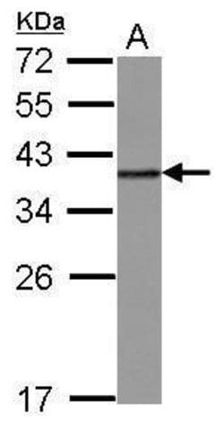 Invitrogen hnRNP A2B1 Polyclonal Antibody 100 &mu;L | Buy Online | Invitrogen&trade; | Fisher Scientific