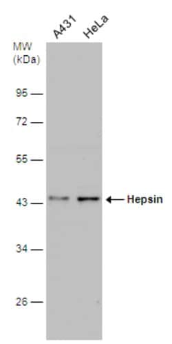 Invitrogen Hepsin Polyclonal Antibody 100 &mu;L; Unconjugated:Antibodies,