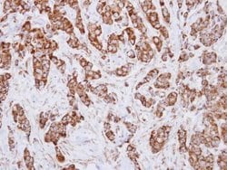 Invitrogen IDH3A Polyclonal Antibody 100 &mu;L | Buy Online | Invitrogen&trade; | Fisher Scientific