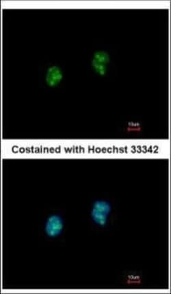Invitrogen ISG20 Polyclonal Antibody 100 &mu;L | Buy Online | Invitrogen&trade; | Fisher Scientific
