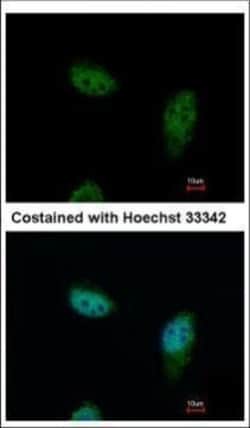 Invitrogen IPO5 Polyclonal Antibody 100 &mu;L; Unconjugated:Antibodies,