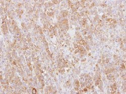 Invitrogen L-Plastin Polyclonal Antibody 100 &mu;L; Unconjugated:Antibodies,
