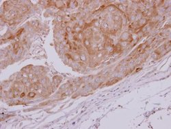 Invitrogen LDHC Polyclonal Antibody 100 &mu;L | Buy Online | Invitrogen&trade; | Fisher Scientific