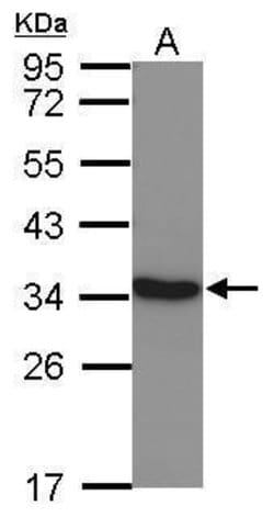 Invitrogen LDHC Polyclonal Antibody 100 &mu;L | Buy Online | Invitrogen&trade; | Fisher Scientific